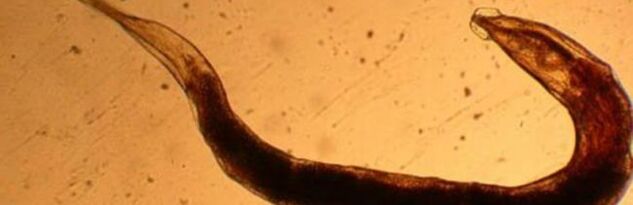 pasożyt robaka z ludzkiego ciała