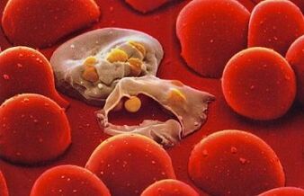 plasmodium malarii w organizmie człowieka